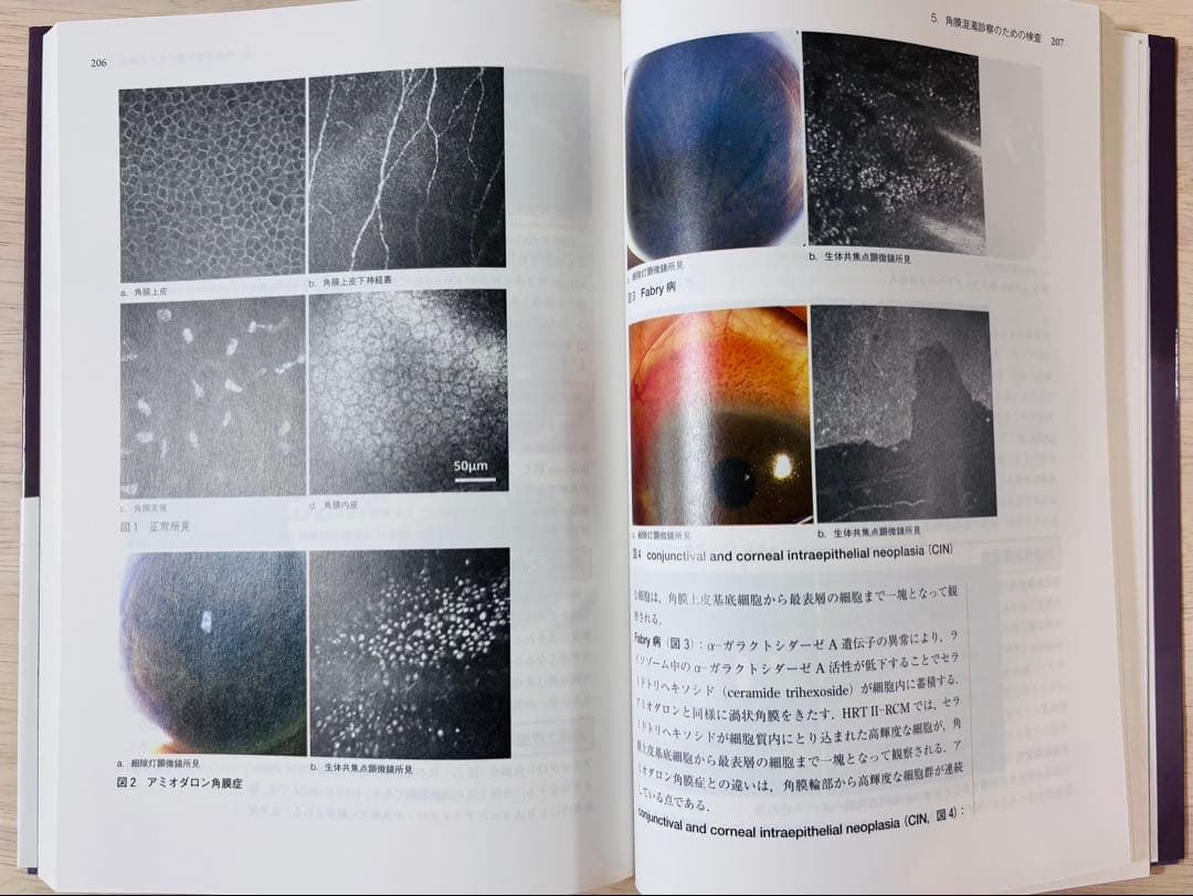 【書き込み少】眼科診療クオリファイ 25 角膜混濁のすべて