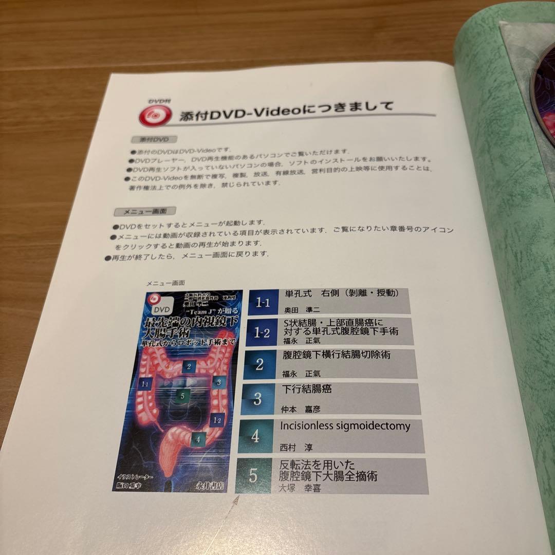 \"Team J\"が贈る最先端の内視鏡下大腸手術 : 単孔式からロボット手術まで