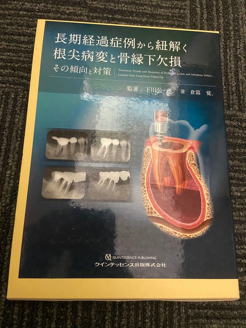 長期経過症例から紐解く根尖病変と骨縁下欠損