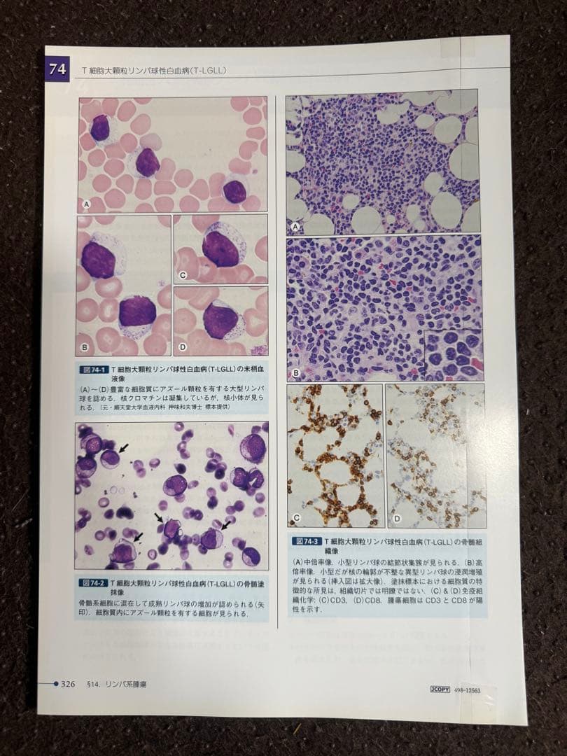 【裁断済】骨髄疾患診断アトラス 血球形態と骨髄病理 第2版
