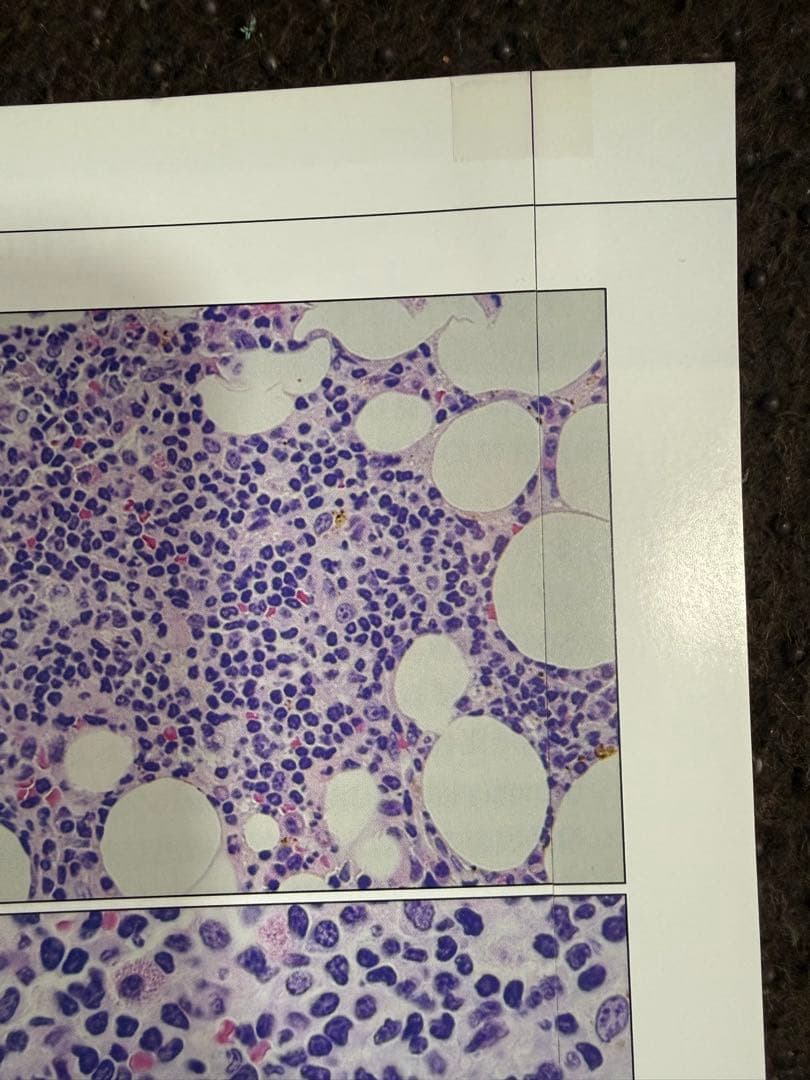 【裁断済】骨髄疾患診断アトラス 血球形態と骨髄病理 第2版