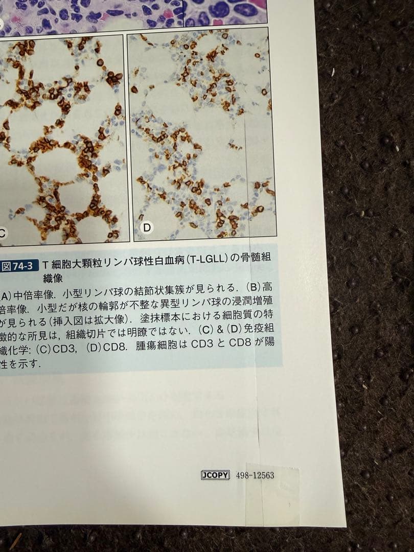 【裁断済】骨髄疾患診断アトラス 血球形態と骨髄病理 第2版