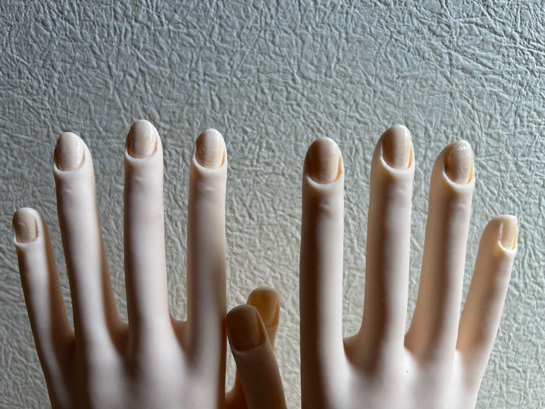 認定モデルハンド 骨折なし