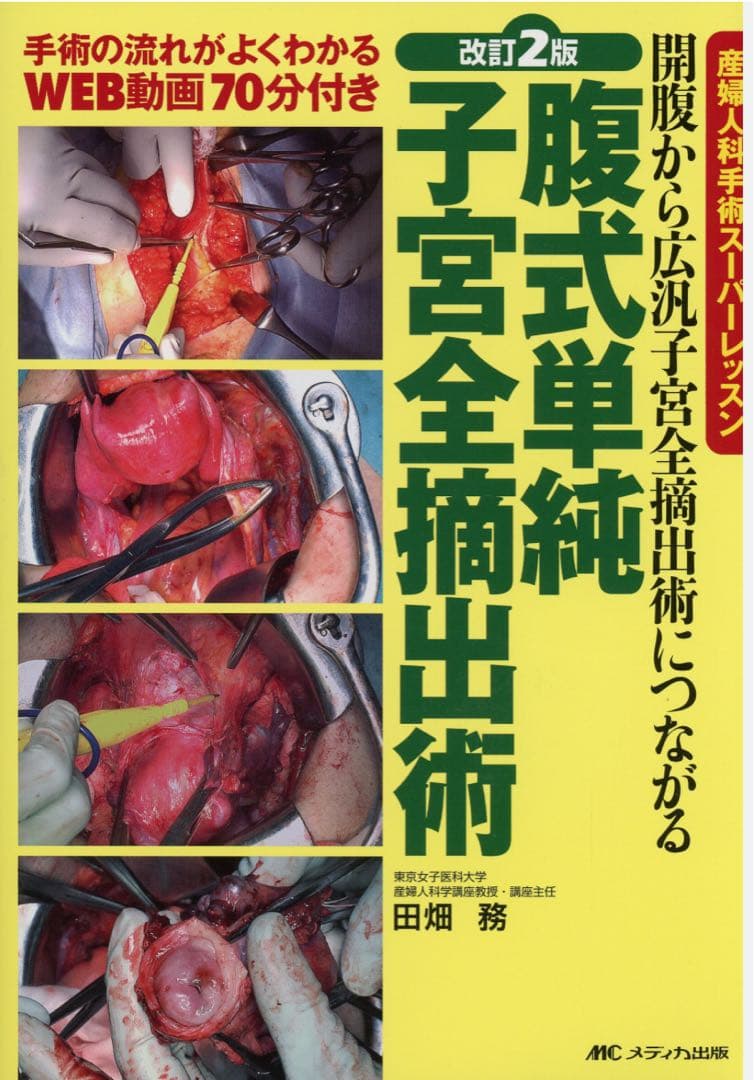 腹式単純子宮全摘出術 改訂2版　裁断済み