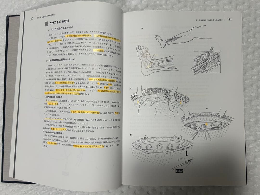 心臓血管外科手術書 磯村