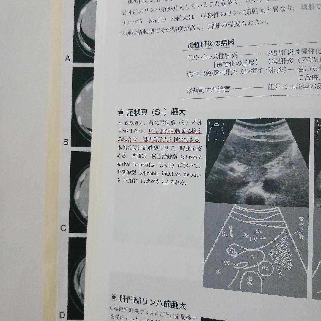 腹部超音波テキスト : 上・下腹部　腹部エコー　参考書　ベクトル・コア