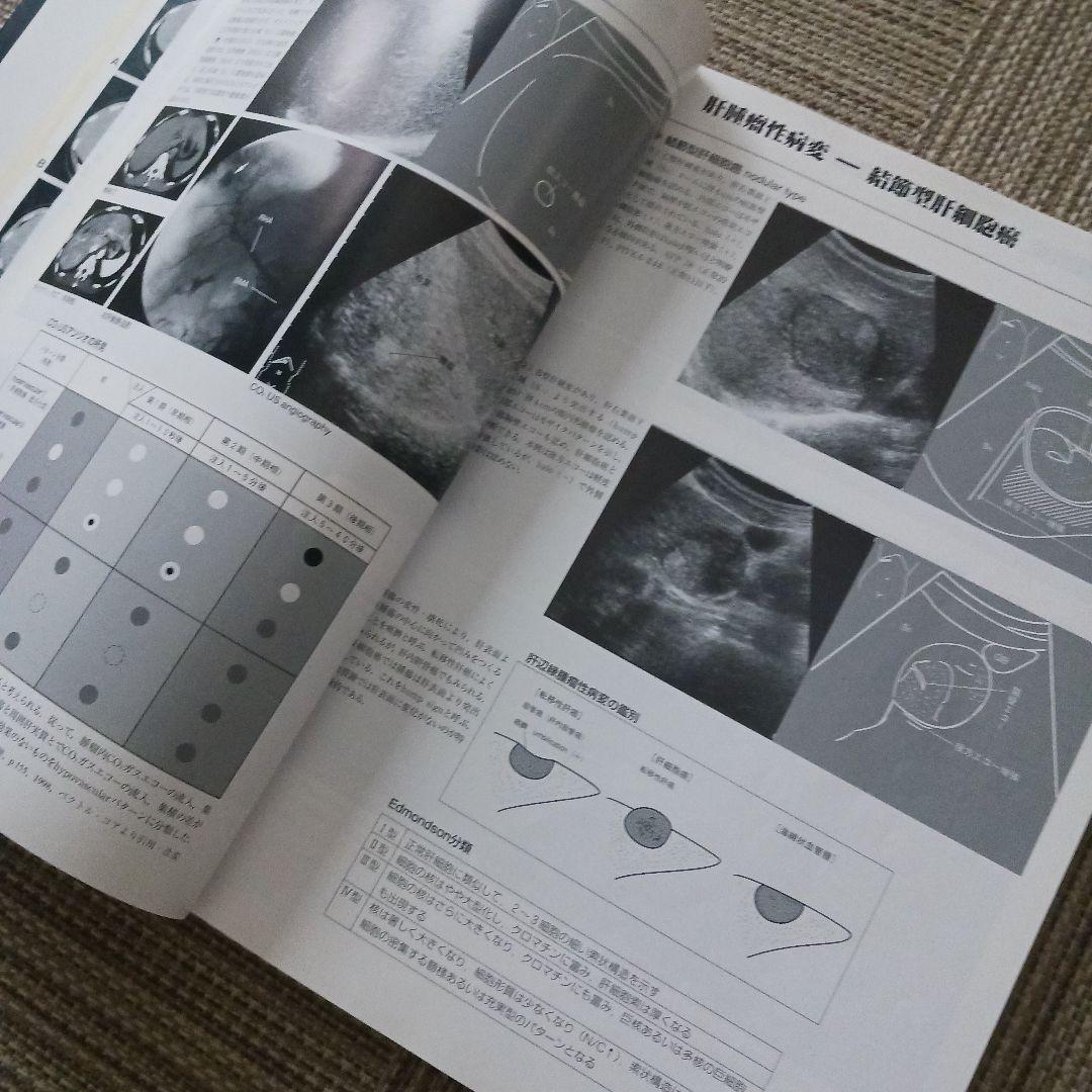 腹部超音波テキスト : 上・下腹部　腹部エコー　参考書　ベクトル・コア