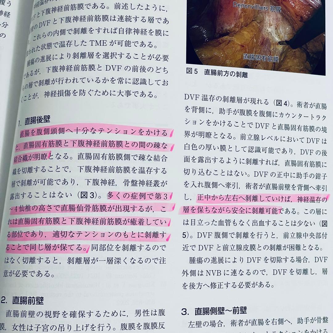 内視鏡外科医のための微細局所解剖アトラス