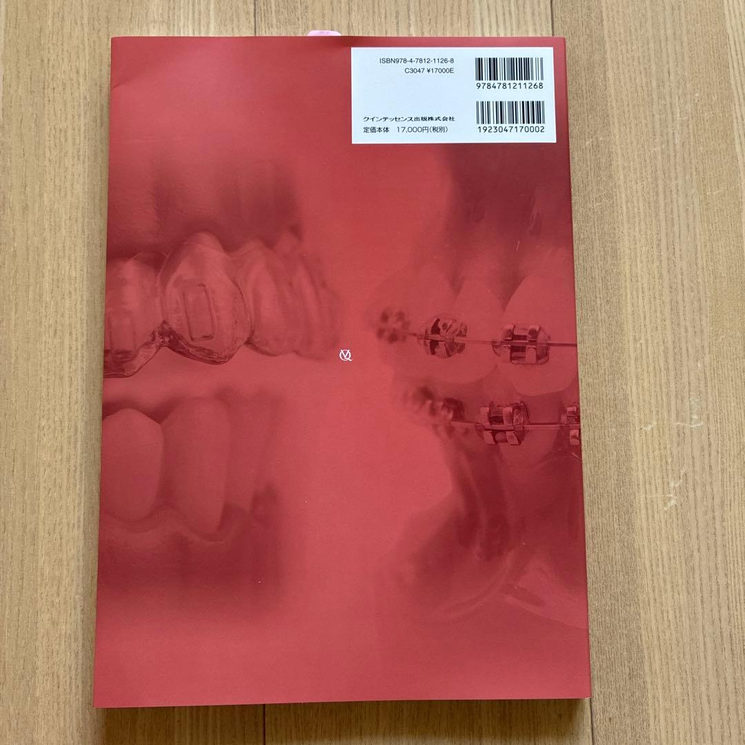 アライナー矯正治療戦略