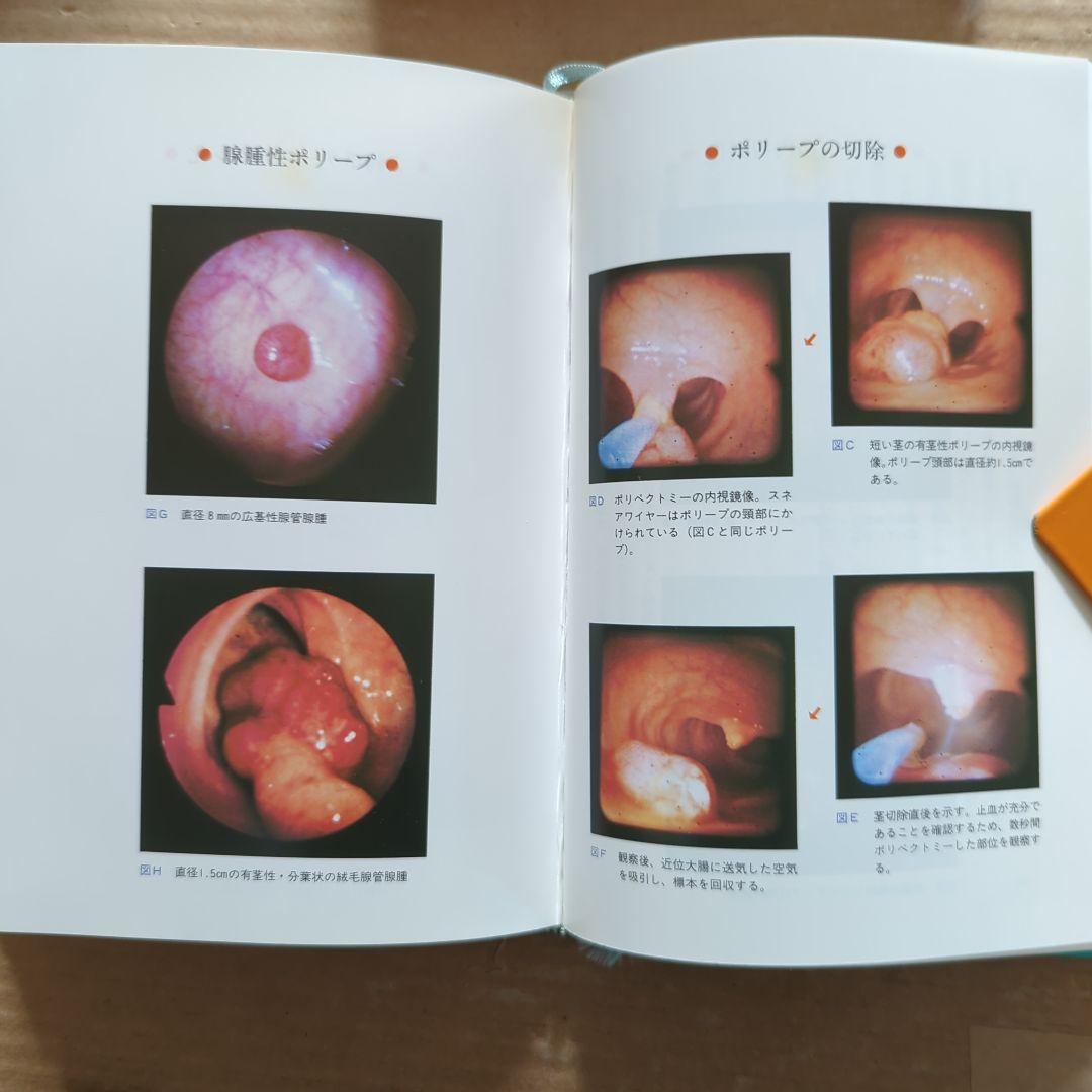 新谷 弘実　病気にならない生き方 胃腸は語る　ガン予防　健康法サプリ玄米ビタミン