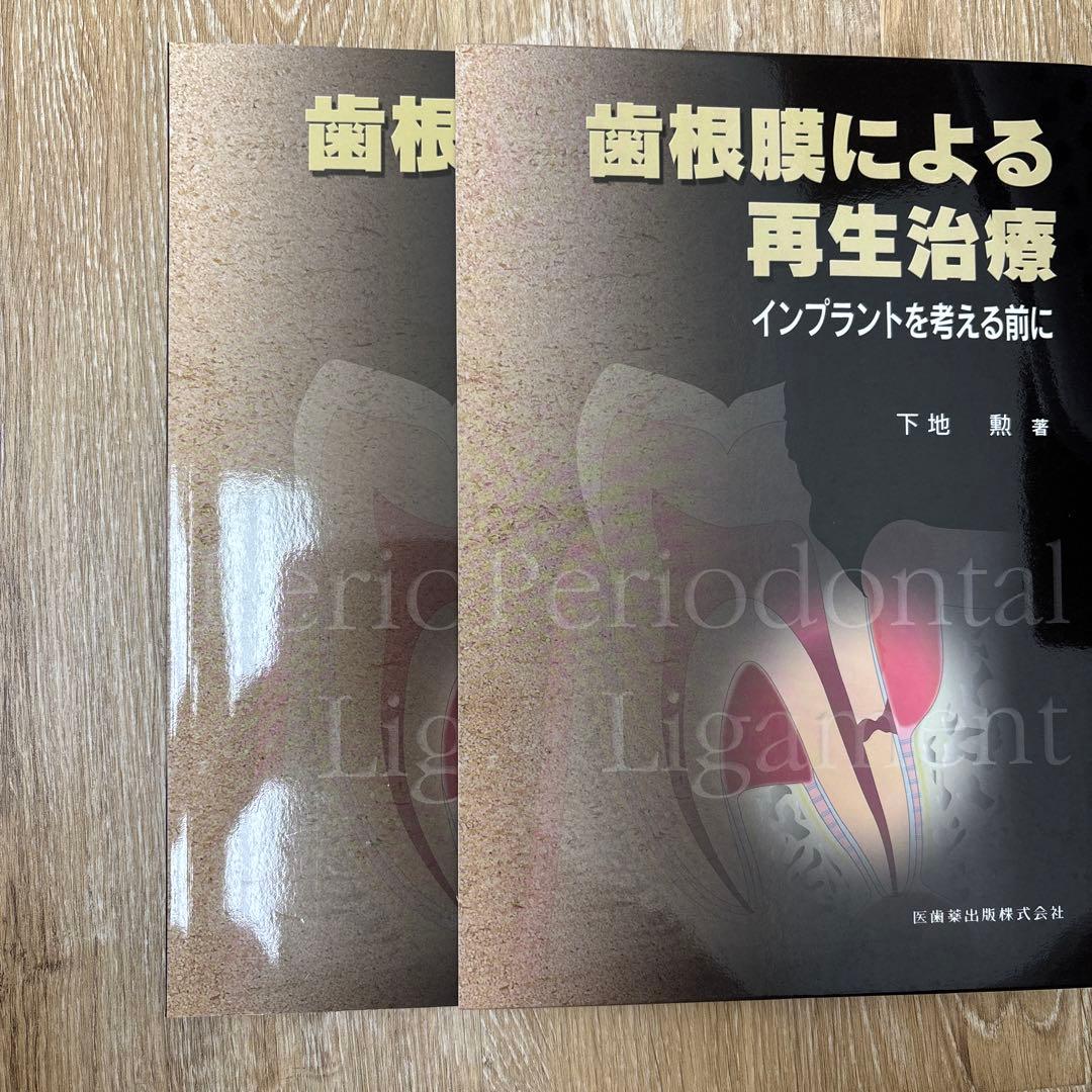 歯根膜による再生治療 : インプラントを考える前に