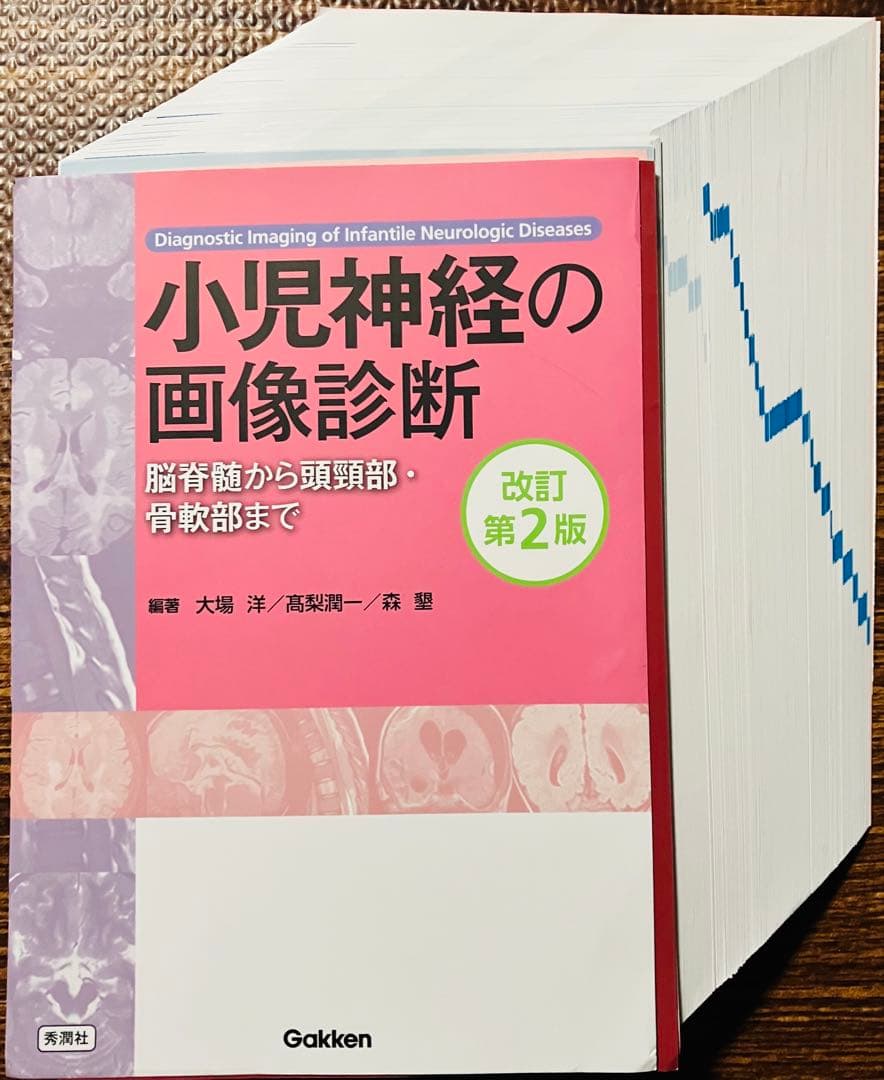【裁断済】小児神経の画像診断 改訂第2版