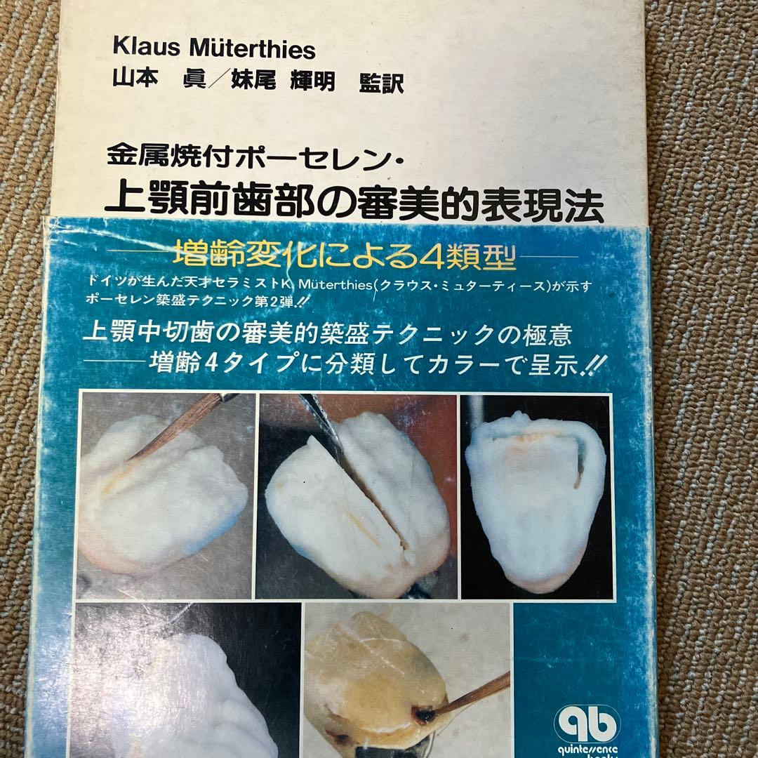 金属焼付ポーセレン 上顎前歯部の審美的表現法　歯科技工