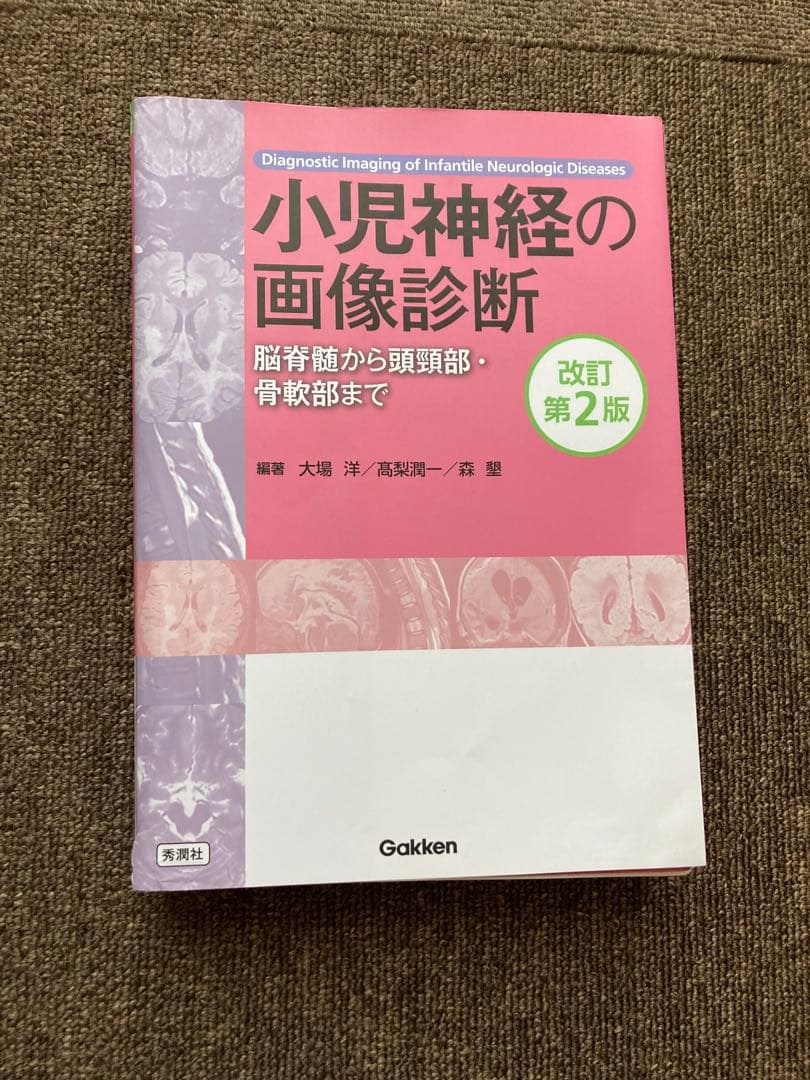 【裁断済み】小児神経の画像診断 第2版