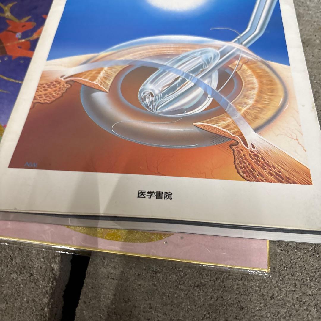 小切開創白内障手術