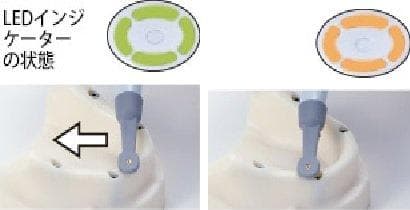 インプラント　ロケーター　「光で知らせるインプラント探知機」