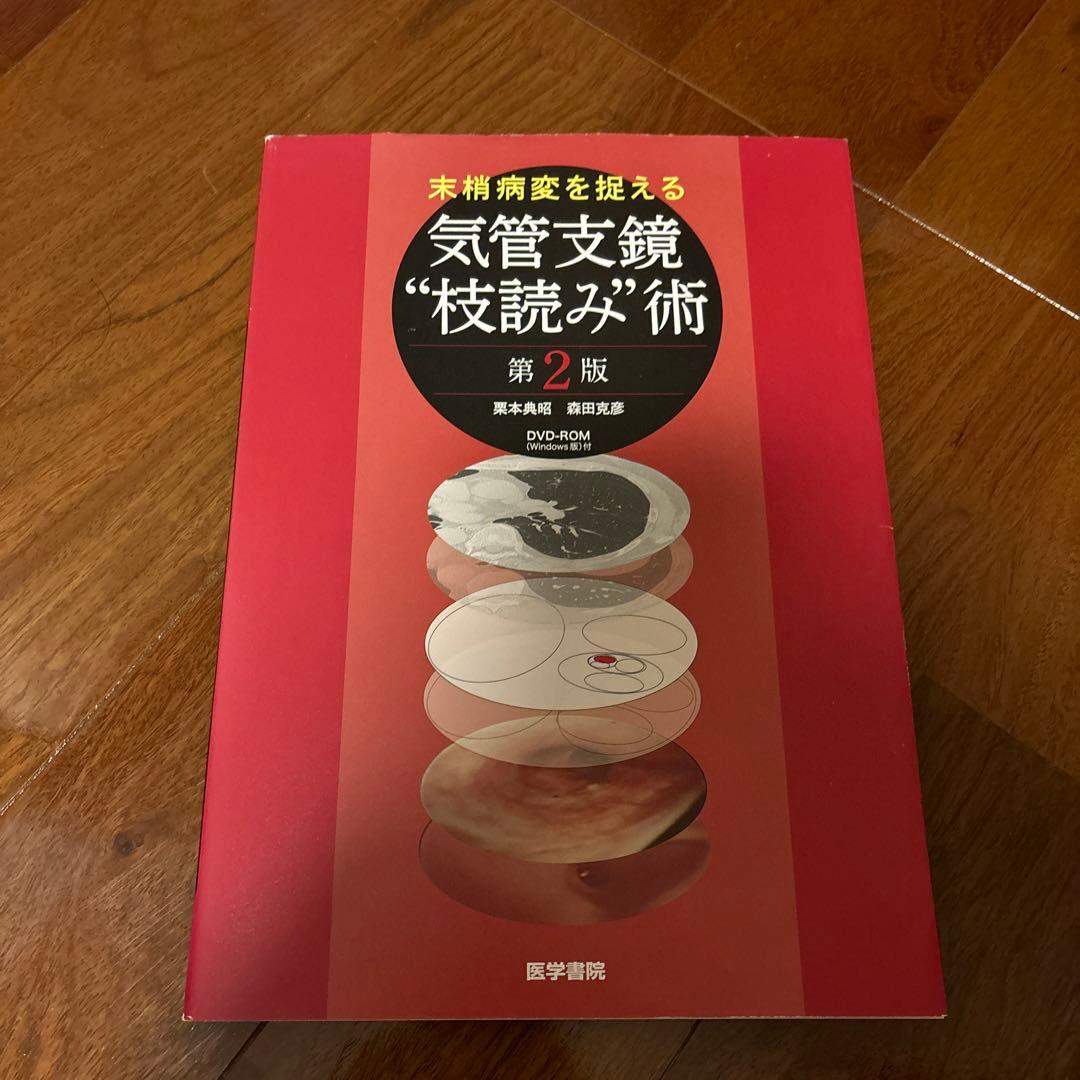 末梢病変を捉える気管支鏡\