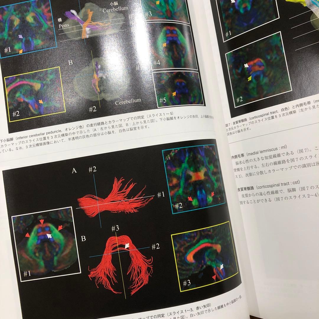 拡散テンソル法によるヒト脳白質のMRIアトラス