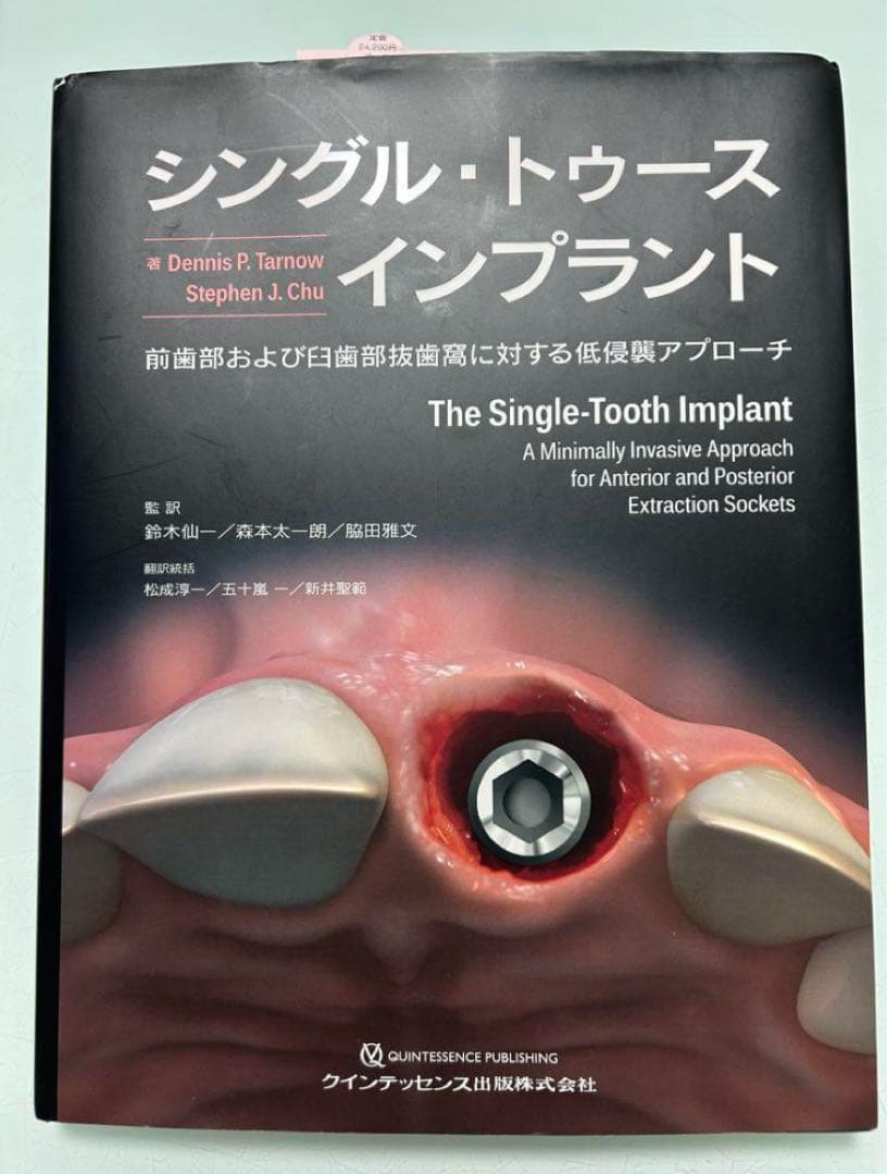 シングル・トゥース インプラント