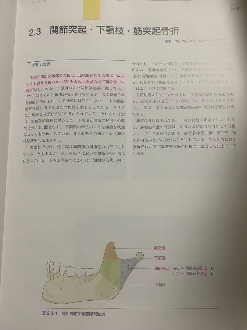 AO法 骨折治療 頭蓋顎顔面骨の内固定