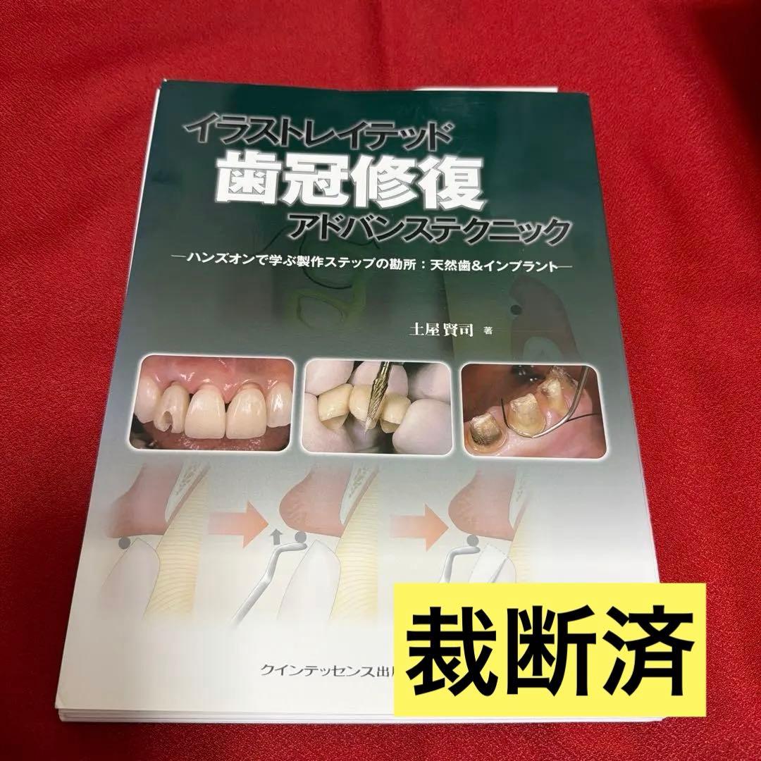 【裁断済】イラストレイテッド歯冠修復アドバンステクニック : ハンズオンで学ぶ