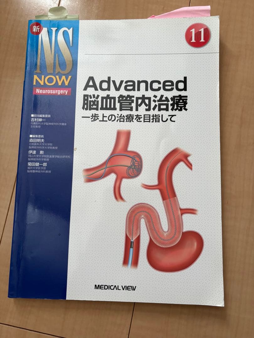 Advanced 脳血管内治療