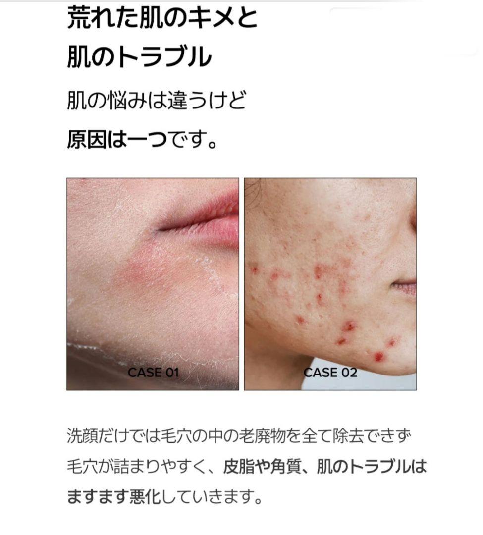 セラディックス　トリプルレチノール　ウォッシュピール　３箱セット　新品未開封