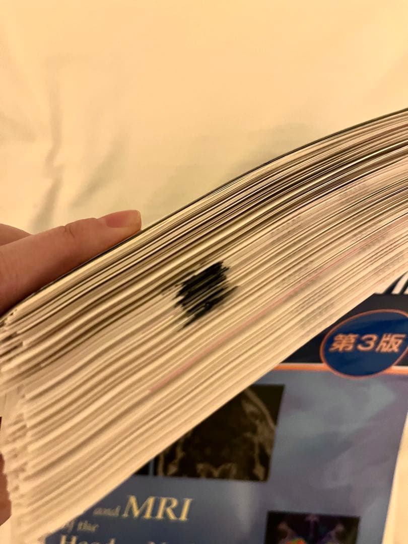 【裁断済】頭頸部のCT・MRI 第3版