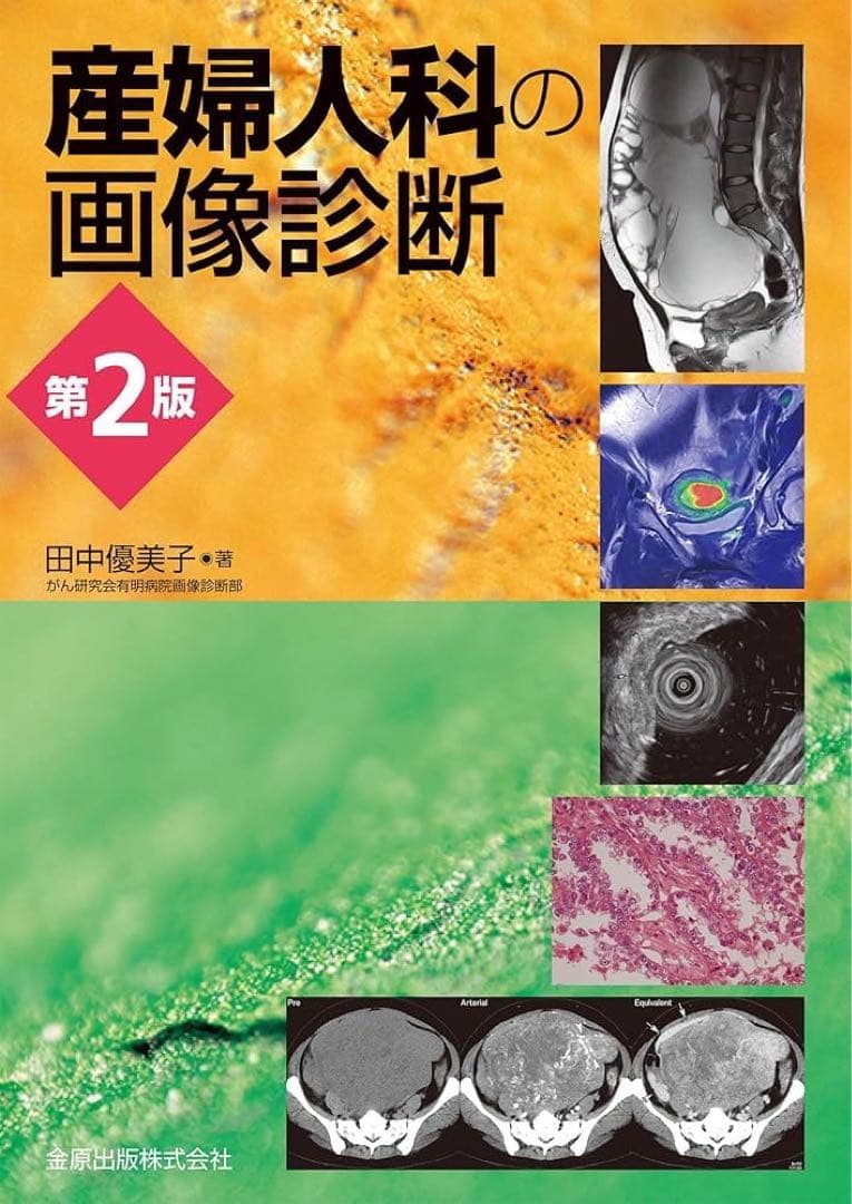 【裁断済み】産婦人科の画像診断　第２版