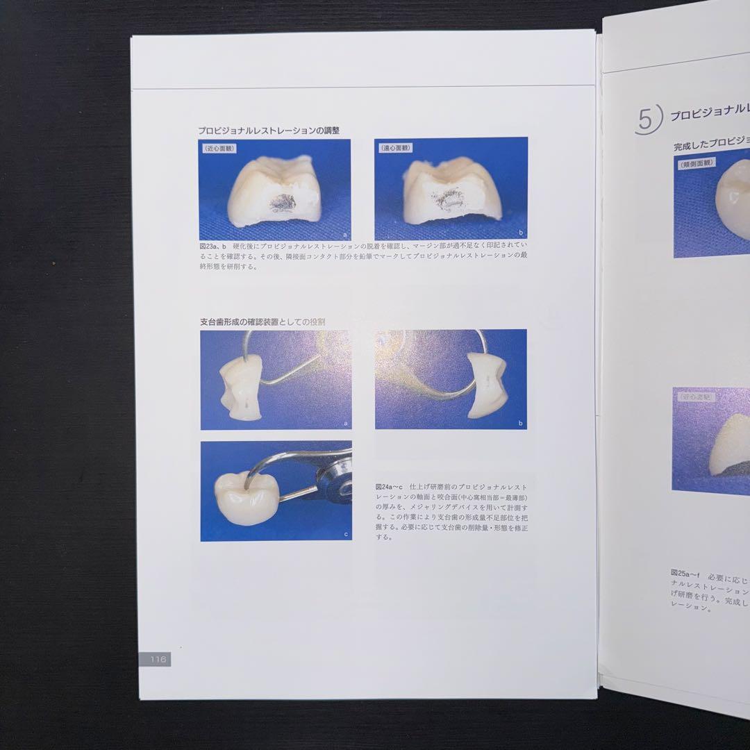必ず上達　デジタル時代の歯冠修復　裁断済み