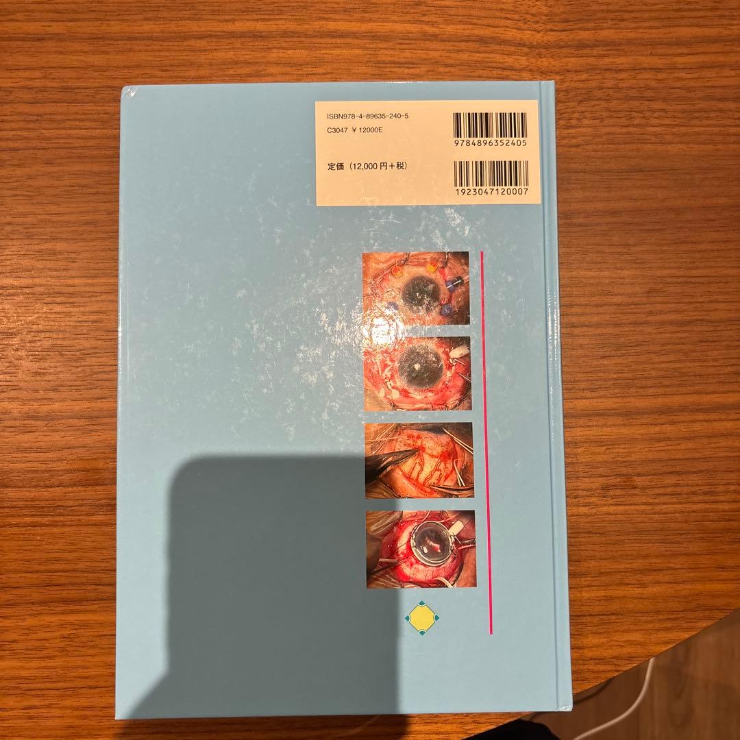 眼科　硝子体手術のワンポイントアドバイス