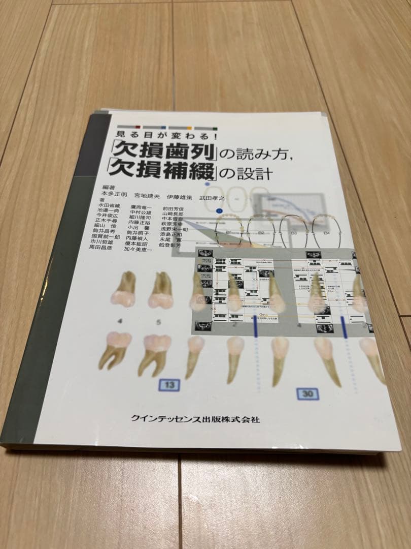 【裁断済】見る目が変わる！　「欠損歯列」の読み方，「欠損補綴」の設計