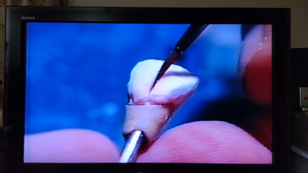 ウィリーゲラー氏の講演とテーブルクリニックビデオ　3本　ポーセレン　歯科技工