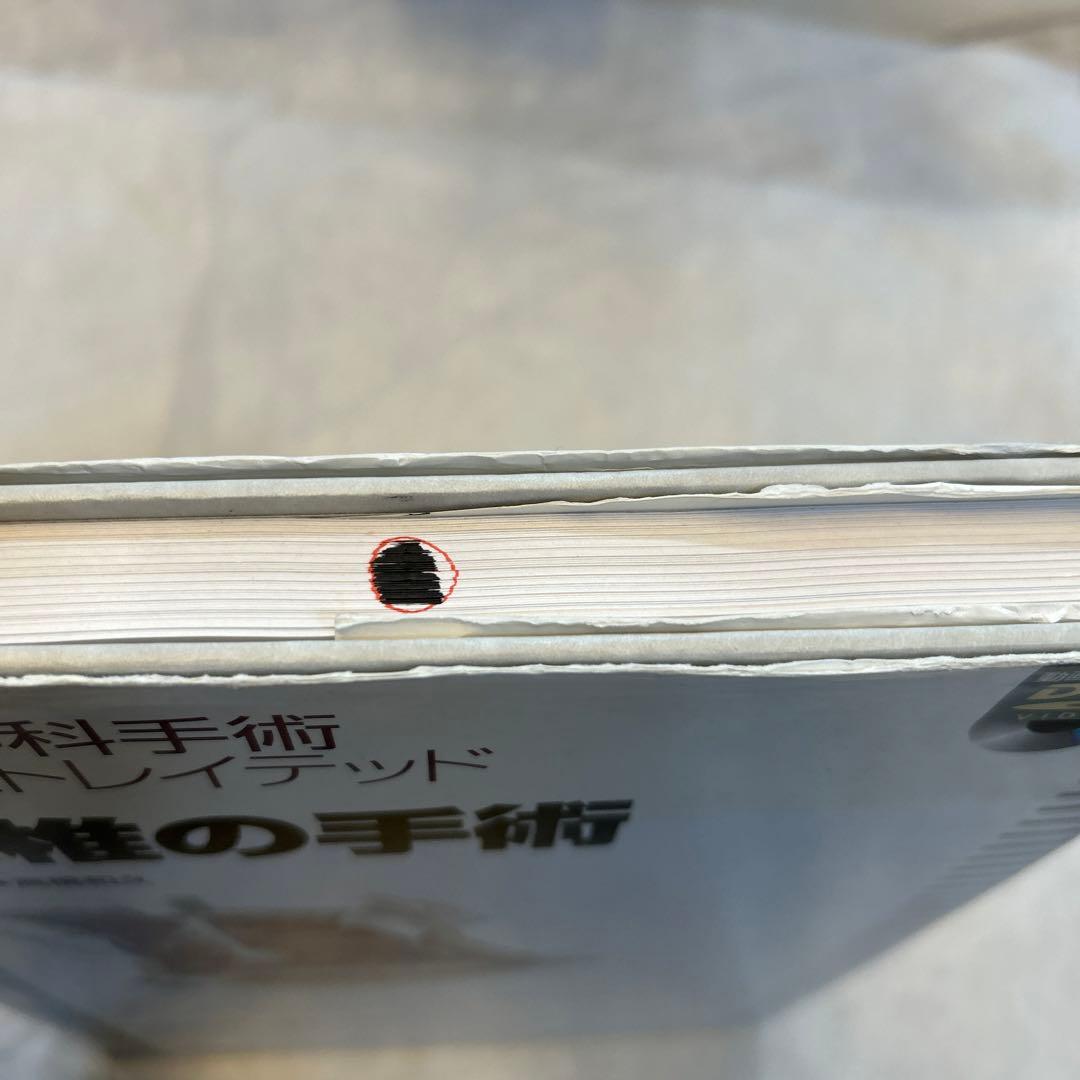 整形外科手術　イラストレイテッド　腰椎の手術