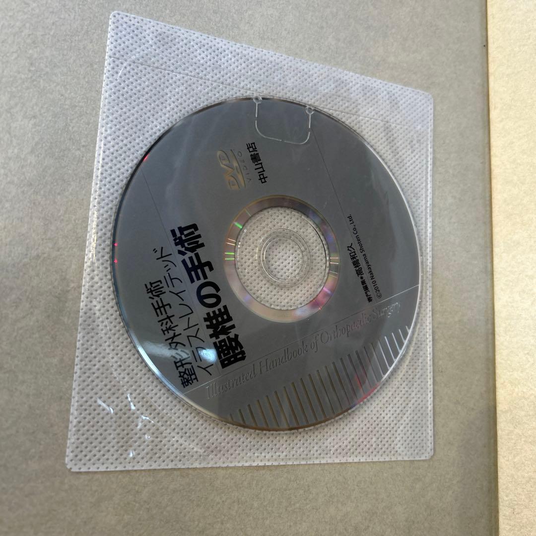 整形外科手術　イラストレイテッド　腰椎の手術