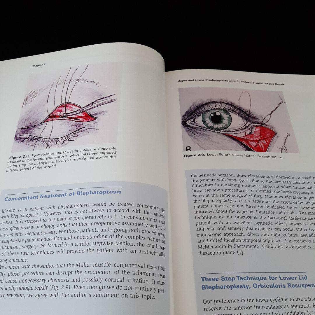美容眼瞼下垂手術テキスト（英語版）