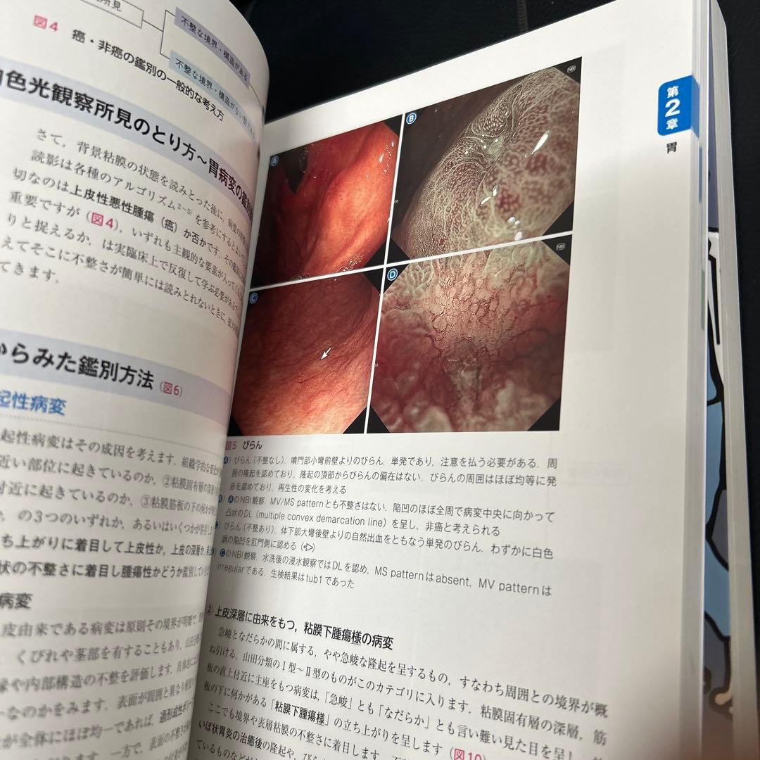 上部消化管内視鏡診断の基本とコツ 消化器内視オオハタ流の基本手 2冊セット