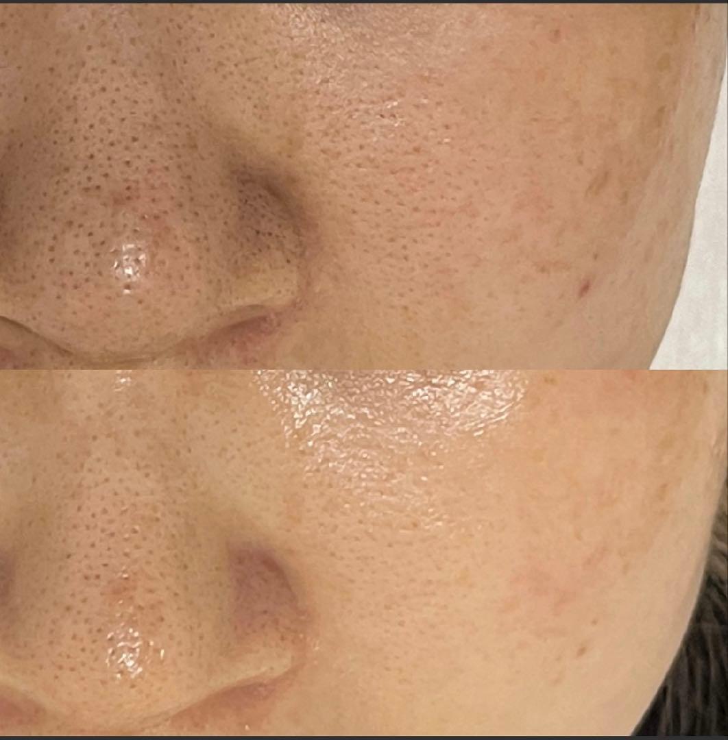 【即発送】セラピール2回分+ブラシ1セット+マスク2枚