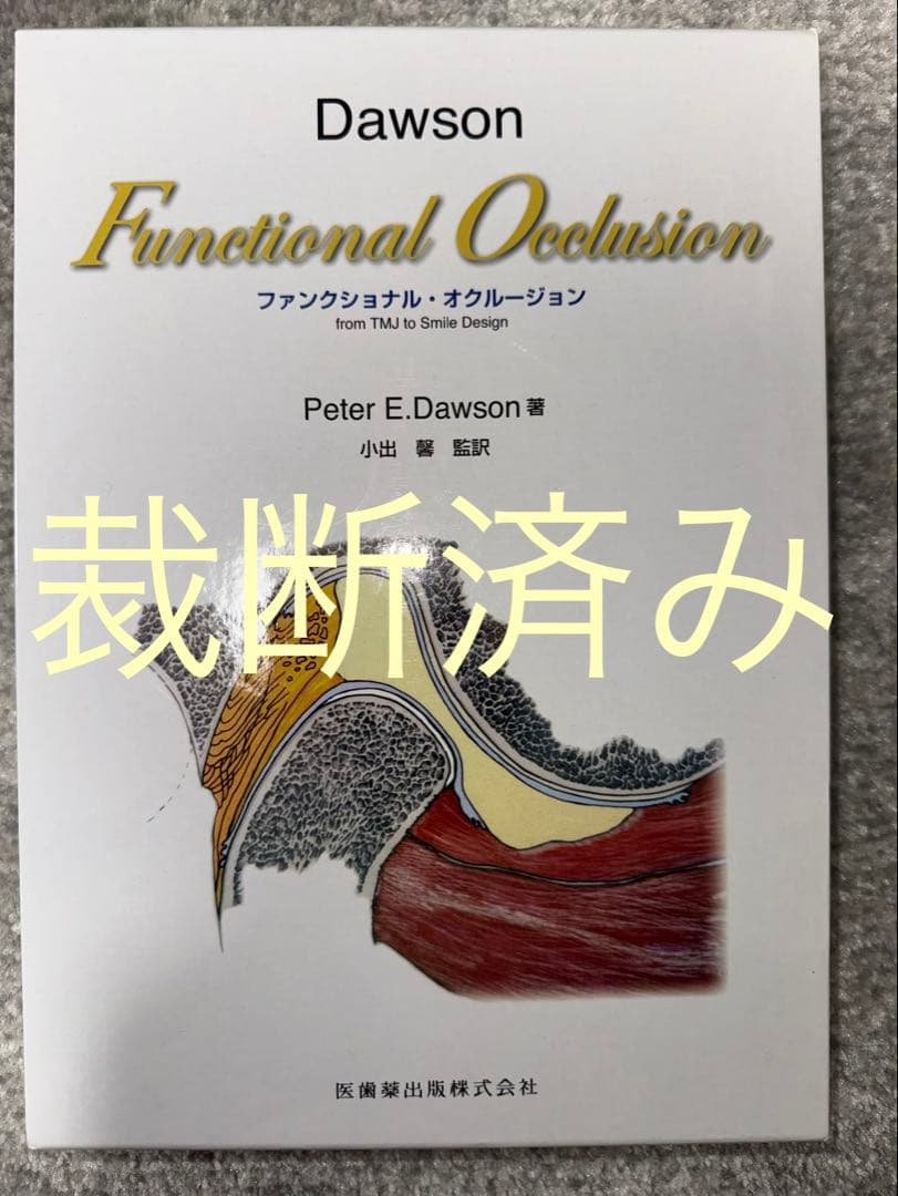 【裁断】Functional Occlusionファンクショナル・オクルージョン