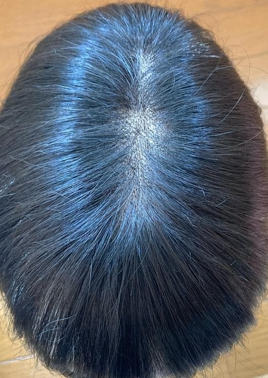 フォンテーヌ　マニフィー　BP921　トップピース　自然色