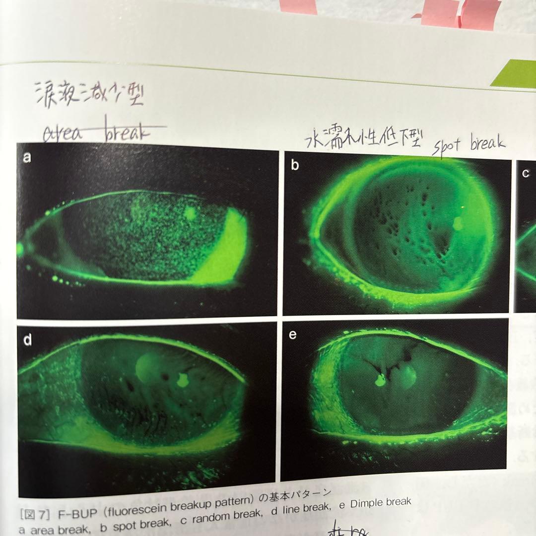 眼科検査ガイド 第3版
