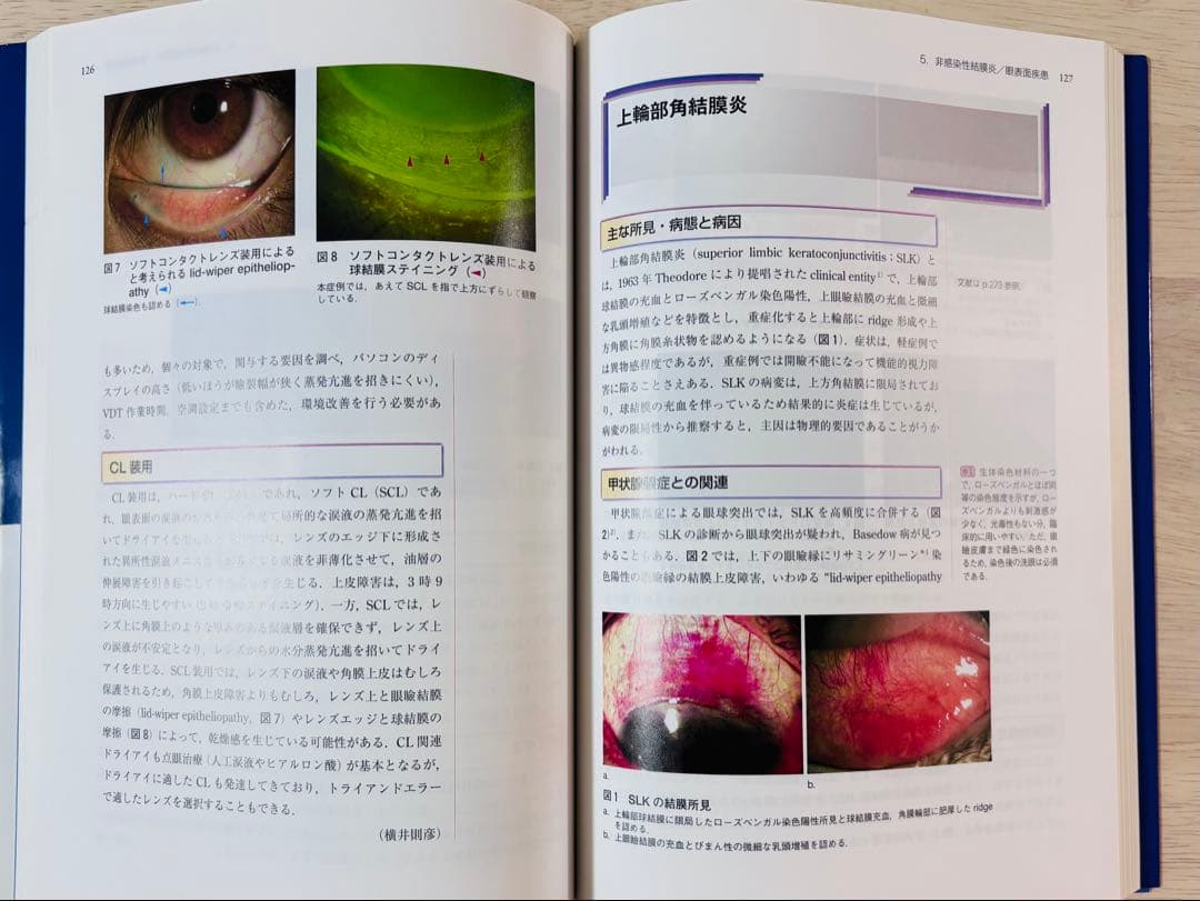 【新品・未使用】眼科診療クオリファイ 2 結膜炎オールラウンド