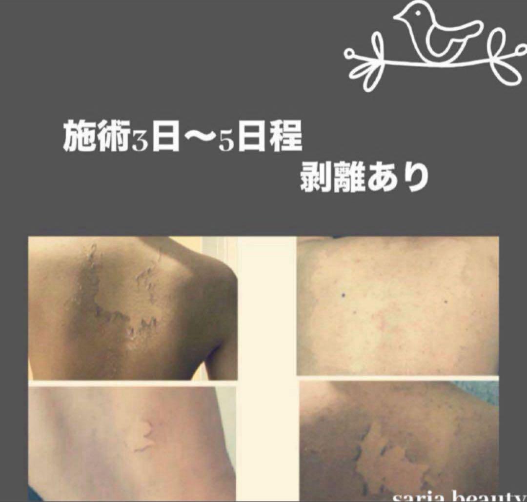 ハーブピーリング　剥離あり　業務用　和漢　オーガニック　新品未開封