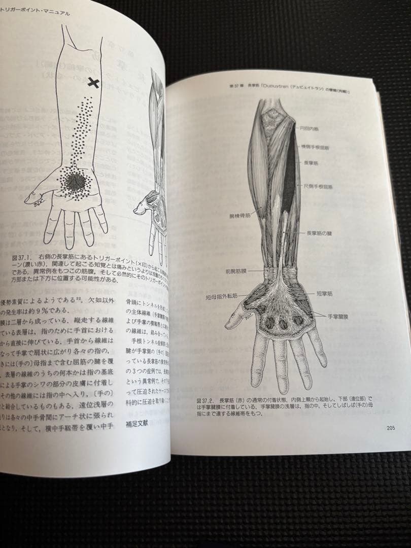 トリガーポイント・マニュアル 第Ⅱ巻　美品