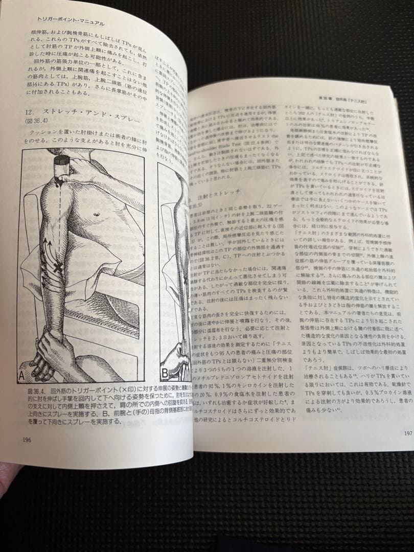 トリガーポイント・マニュアル 第Ⅱ巻　美品