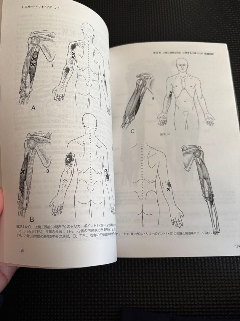 トリガーポイント・マニュアル 第Ⅱ巻　美品