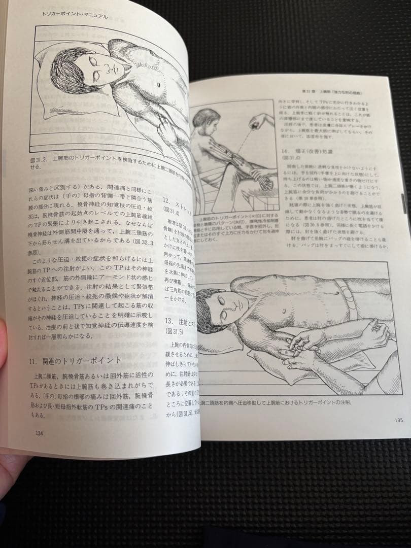 トリガーポイント・マニュアル 第Ⅱ巻　美品