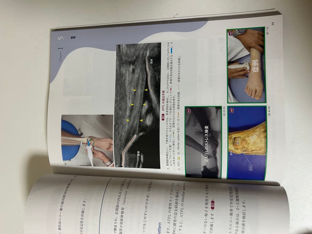 運動器エコーのメタ診断