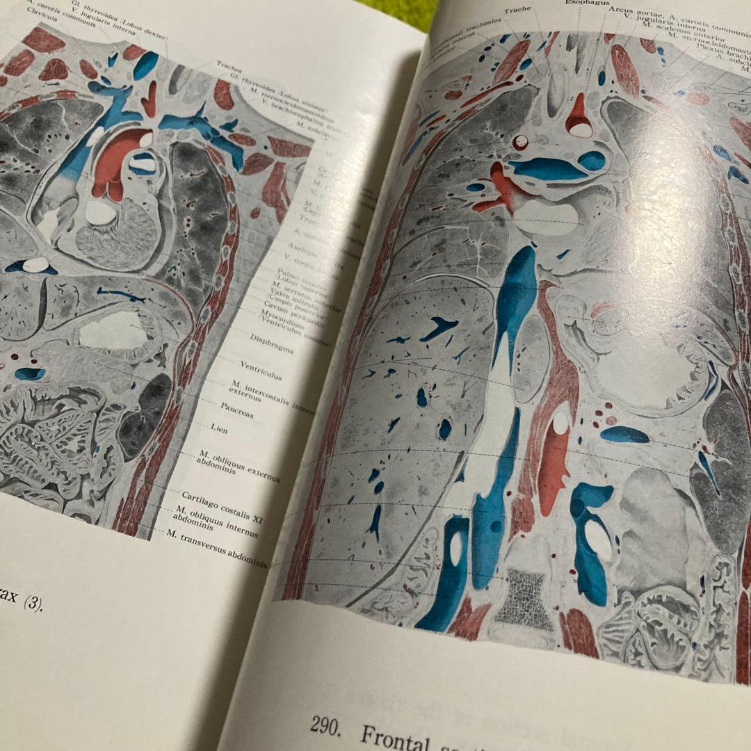 人体局所解剖図譜　セット4冊