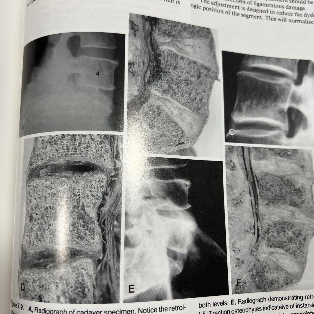 解剖学・神経診察関連書籍セット　まとめて４冊